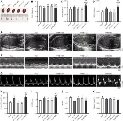 Hydrogen sulfide alleviates uremic cardiomyopathy by regulating PI3K/PKB/mTOR-mediated overactive autophagy in 5/6 nephrectomy mice